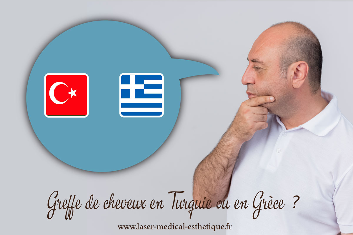 Greffe de cheveux en Turquie ou en Grèce