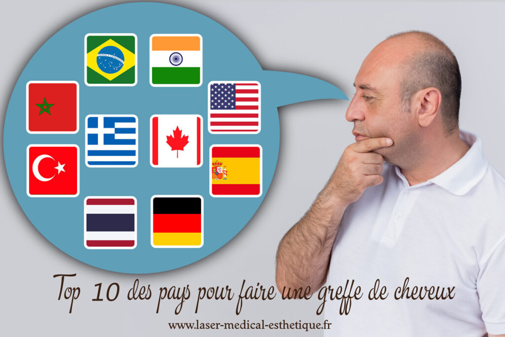 Top 10 des pays pour faire une greffe de cheveux