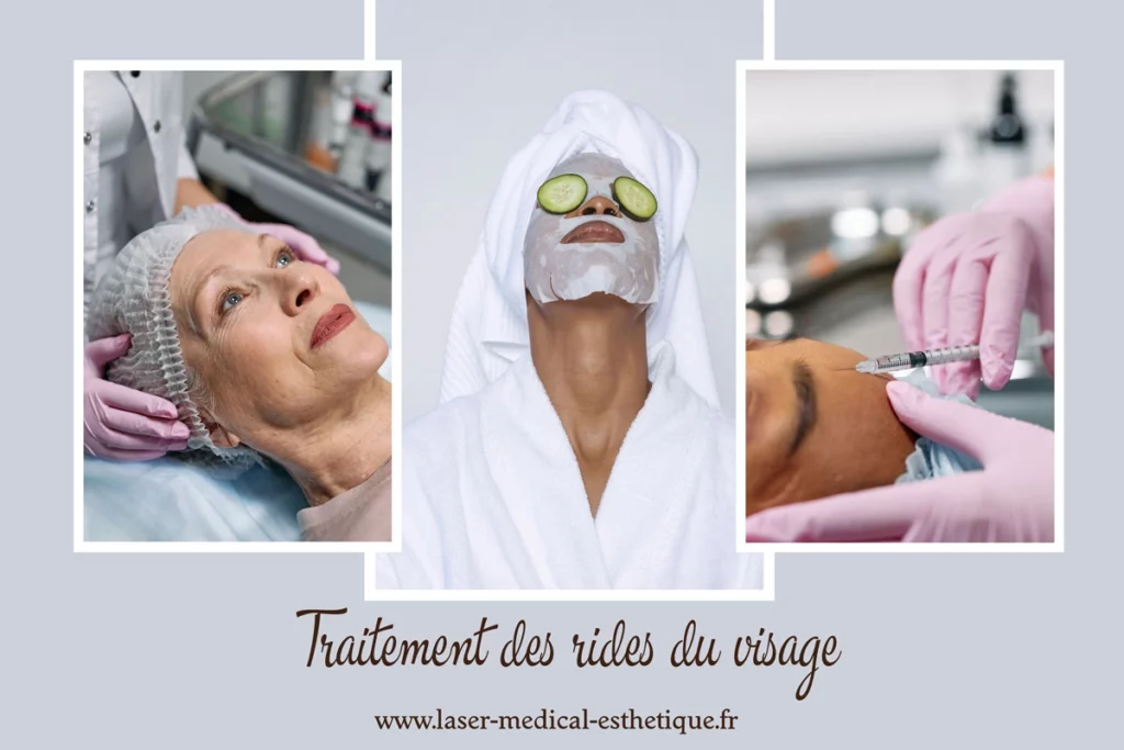 Traitement des rides du visage